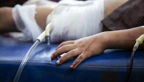 Cada 27 días un niño es herido de bala en Uruguay lo que ya dejó de ser inusual en los hospitales